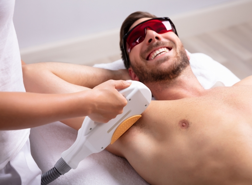 Epilation laser définitive pour homme - Science de la Beauté